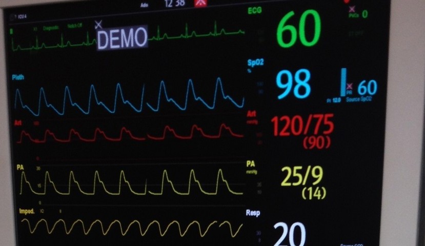 hospital heart monitor