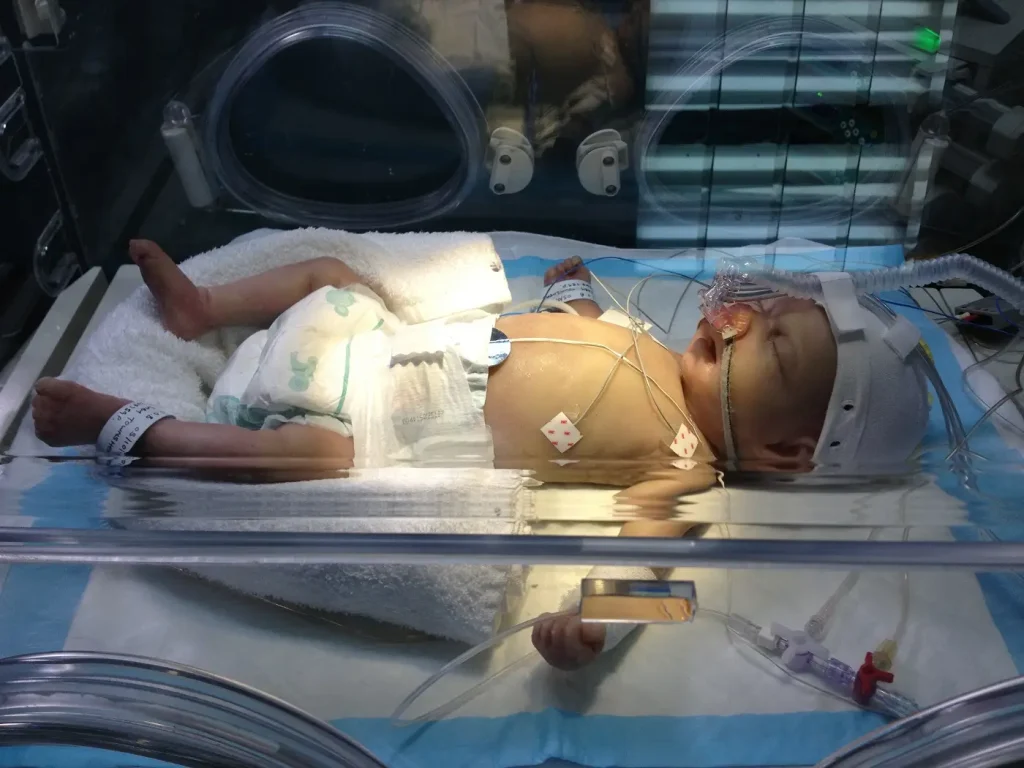Baby unit incubator close up