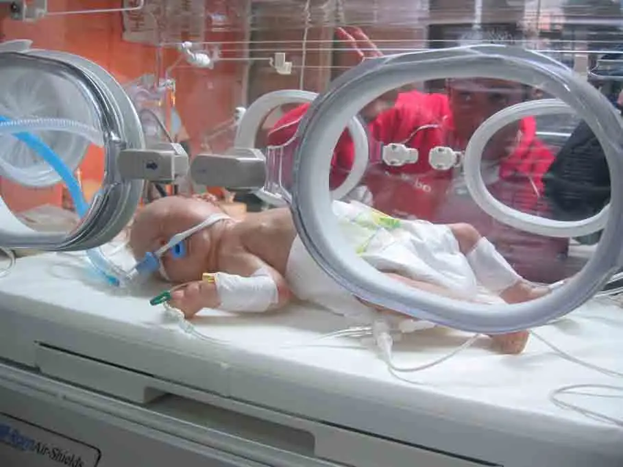 baby unit intensive care